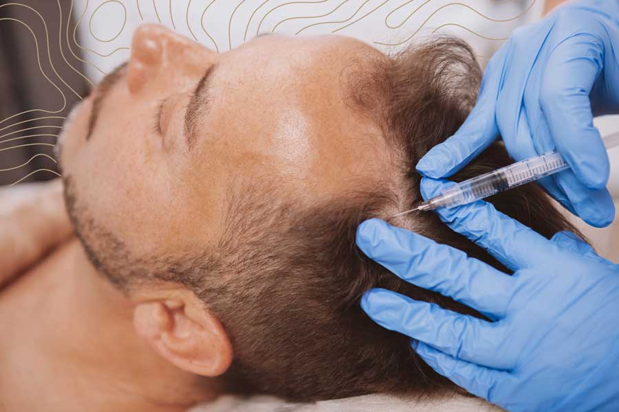La mesoterapia para el cabello en CM-Clinic funciona con éxito