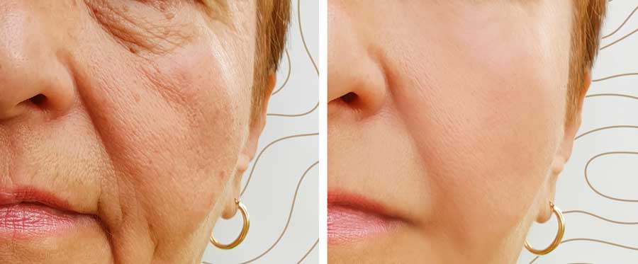 Cm-Clinic mejora la estética facial de sus pacientes